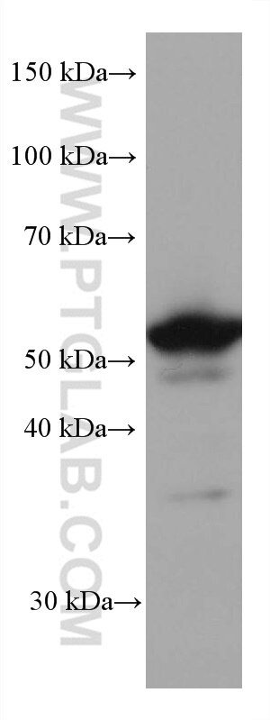 Western Blot (WB) analysis of human placenta tissue using ILK Monoclonal antibody (67724-1-Ig)