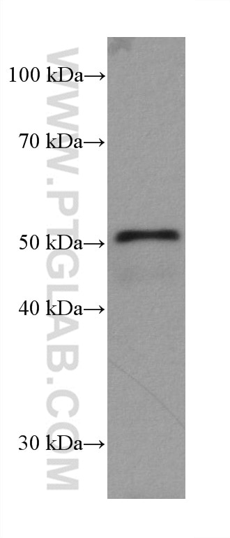Western Blot (WB) analysis of rat colon tissue using ILK Monoclonal antibody (67724-1-Ig)