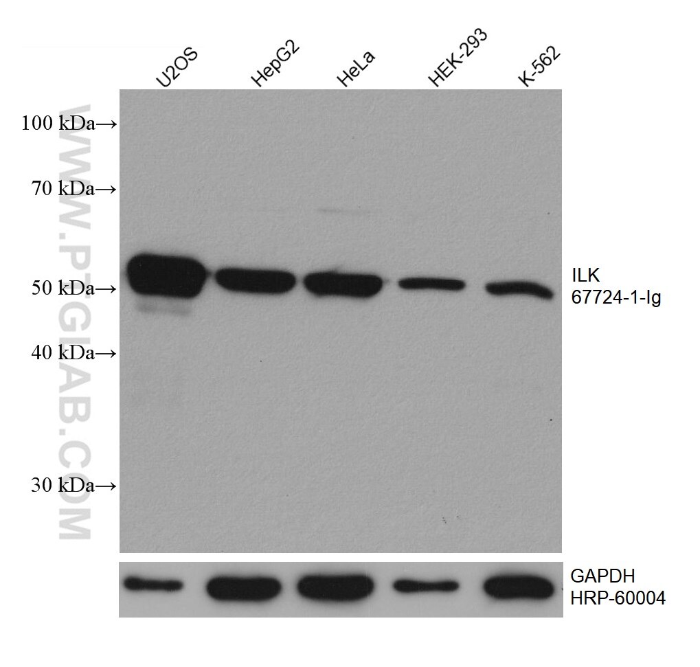 Western Blot (WB) analysis of various lysates using ILK Monoclonal antibody (67724-1-Ig)