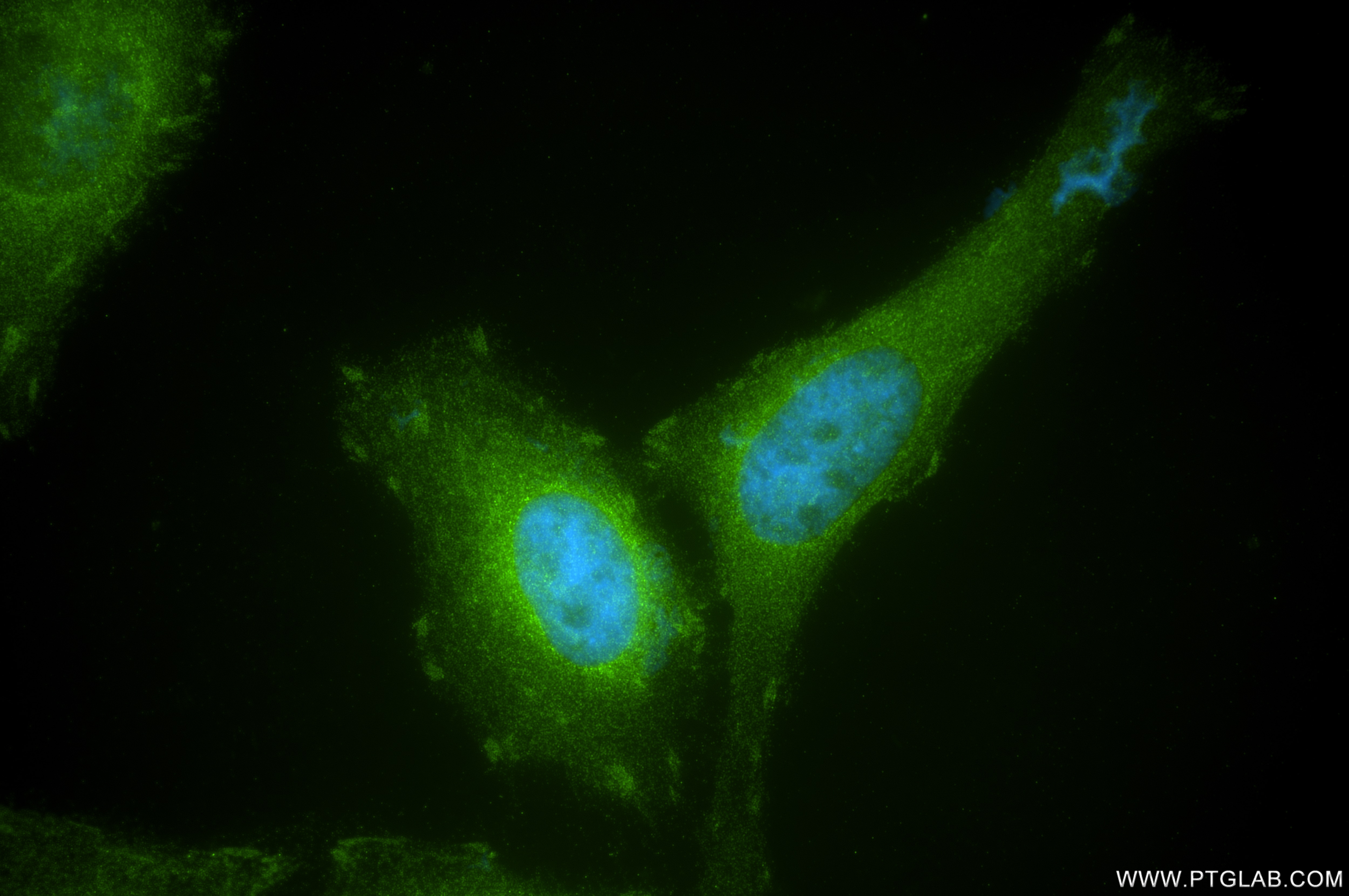 Immunofluorescence (IF) / fluorescent staining of HeLa cells using ILK Recombinant antibody (85428-5-RR)