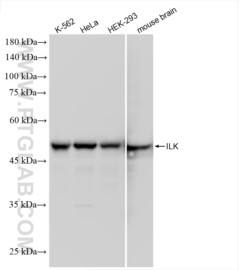 Western Blot (WB) analysis of various lysates using ILK Recombinant antibody (85428-5-RR)