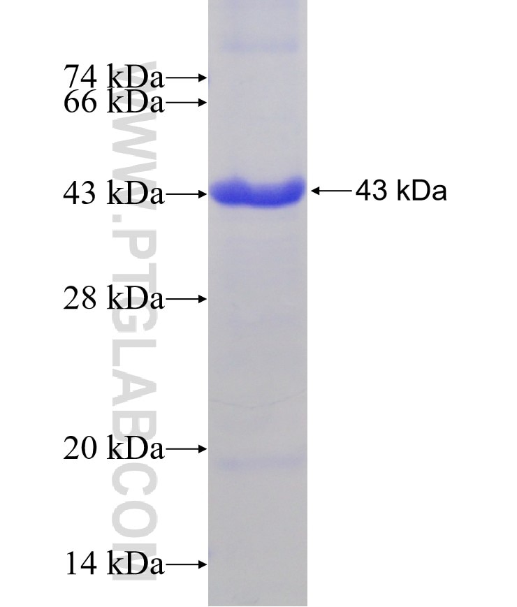 ILK fusion protein Ag21289 SDS-PAGE