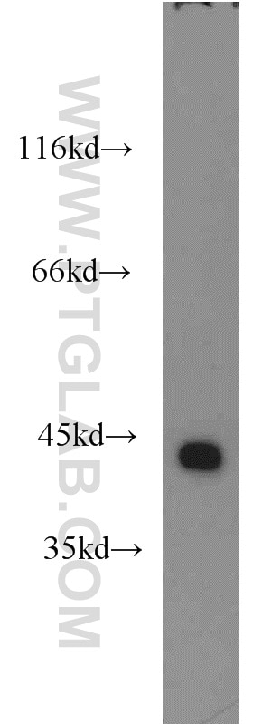 Western Blot (WB) analysis of human heart tissue using ILKAP Polyclonal antibody (16017-1-AP)