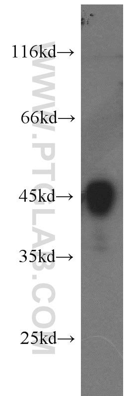 Western Blot (WB) analysis of K-562 cells using ILKAP Polyclonal antibody (16017-1-AP)