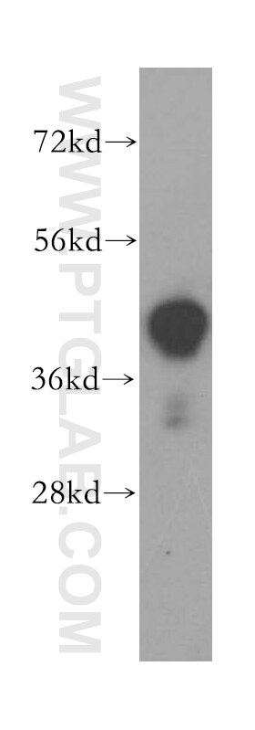 Western Blot (WB) analysis of human heart tissue using ILKAP Polyclonal antibody (16017-1-AP)