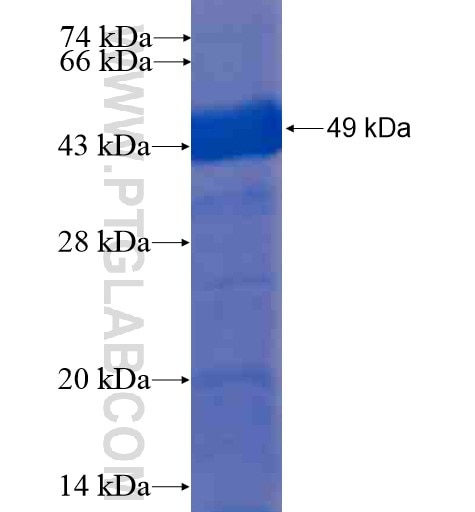 ILKAP fusion protein Ag8826 SDS-PAGE