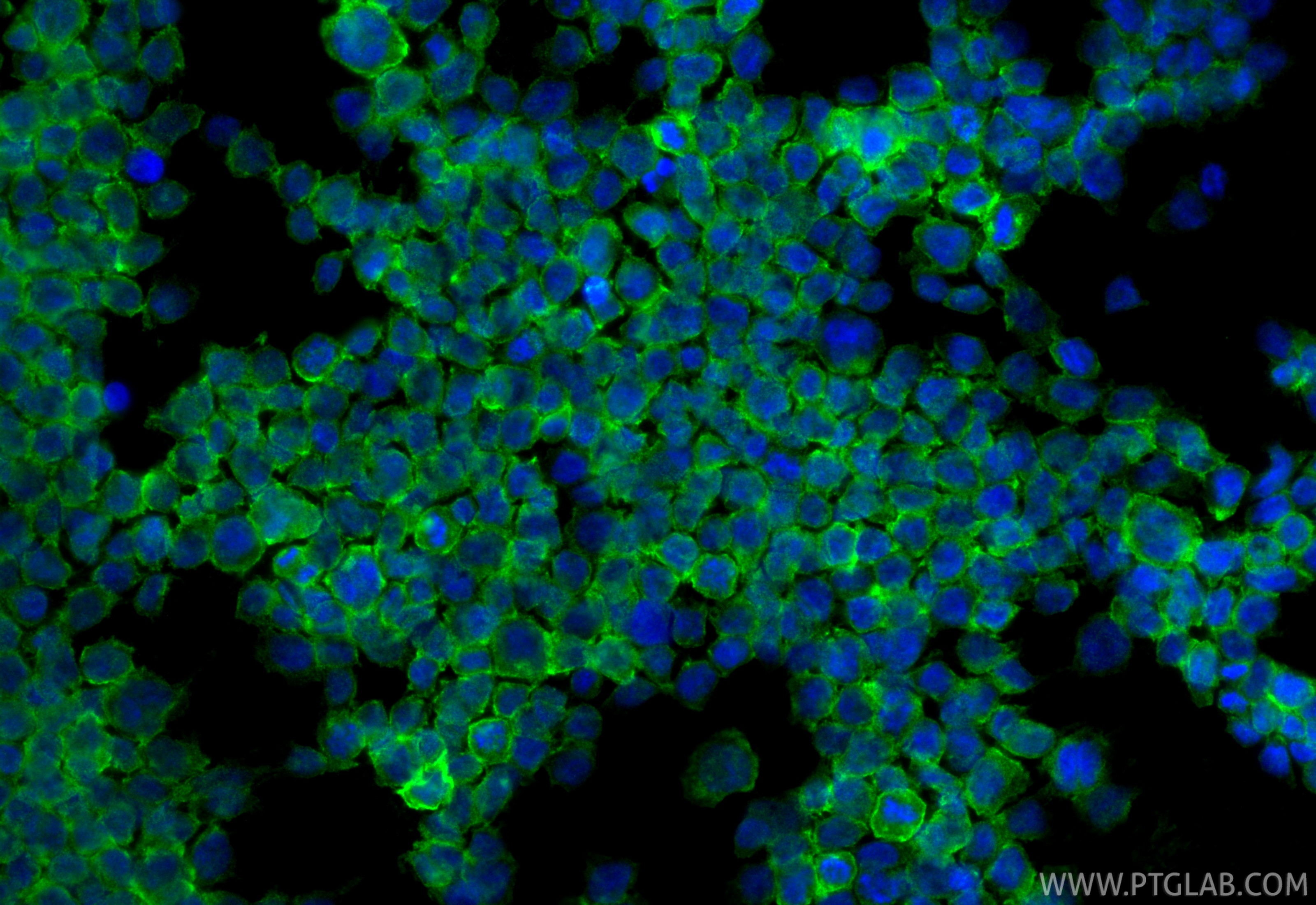 IF Staining of THP-1 using 28422-1-AP Immunofluorescence (IF) / fluorescent staining of THP-1 cells using ILT-3/LILRB4 Polyclonal antibody (28422-1-AP)