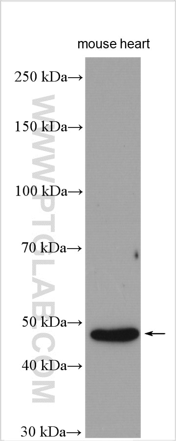 Western Blot (WB) analysis of mouse heart tissue using ILT-3/LILRB4 Polyclonal antibody (28422-1-AP)