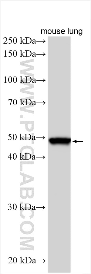 Western Blot (WB) analysis of various lysates using ILT-3/LILRB4 Polyclonal antibody (28422-1-AP)