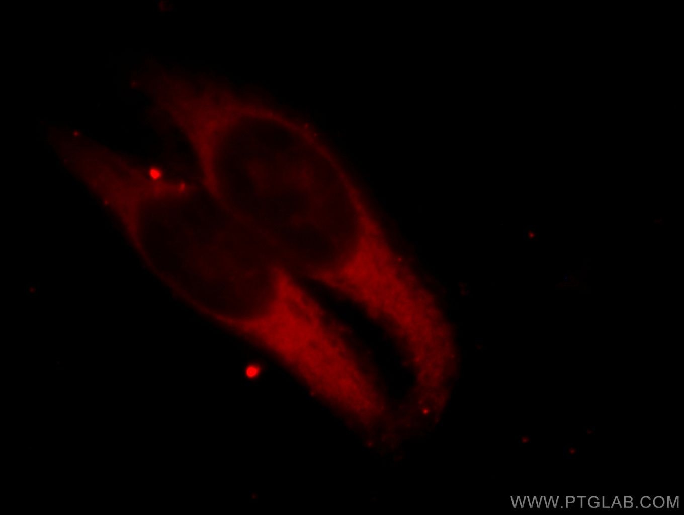 Immunofluorescence (IF) / fluorescent staining of HeLa cells using ILVBL Polyclonal antibody (11220-1-AP)