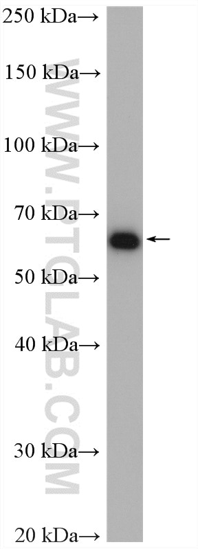 Western Blot (WB) analysis of HepG2 cells using ILVBL Polyclonal antibody (11220-1-AP)