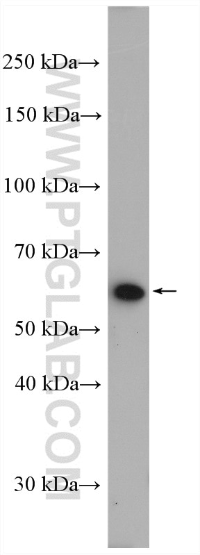 Western Blot (WB) analysis of A549 cells using ILVBL Polyclonal antibody (11220-1-AP)