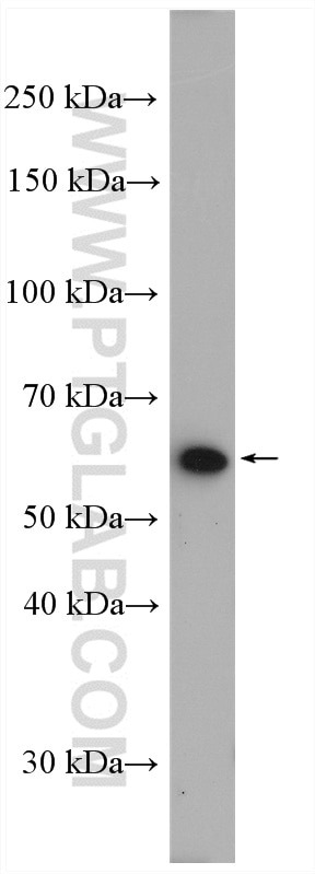 WB analysis of A549 using 11220-1-AP