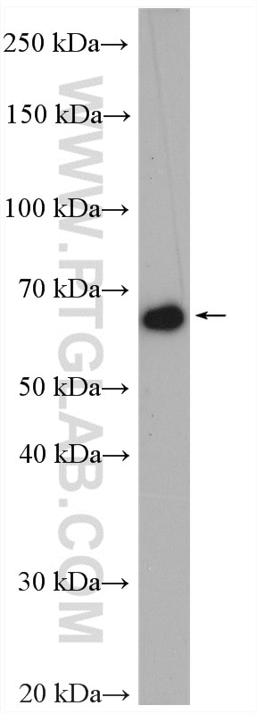 Western Blot (WB) analysis of HeLa cells using ILVBL Polyclonal antibody (11220-1-AP)