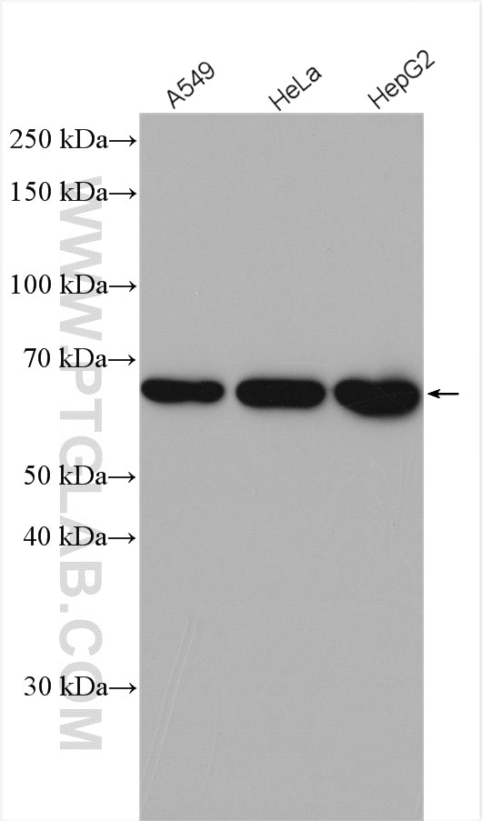 Western Blot (WB) analysis of various lysates using ILVBL Polyclonal antibody (11220-1-AP)