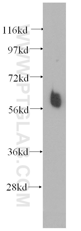 Western Blot (WB) analysis of human thyroid gland tissue using ILVBL Polyclonal antibody (11220-1-AP)