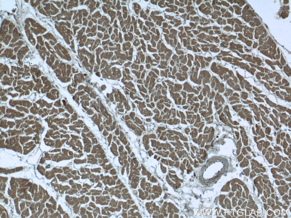 Immunohistochemistry (IHC) staining of human heart tissue using ILVBL Polyclonal antibody (24738-1-AP)