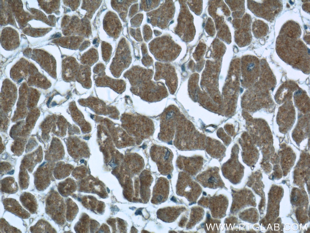 Immunohistochemistry (IHC) staining of human heart tissue using ILVBL Polyclonal antibody (24738-1-AP)
