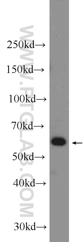 Western Blot (WB) analysis of MCF-7 cells using ILVBL Polyclonal antibody (24738-1-AP)