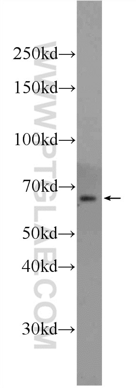 Western Blot (WB) analysis of HepG2 cells using ILVBL Polyclonal antibody (24738-1-AP)