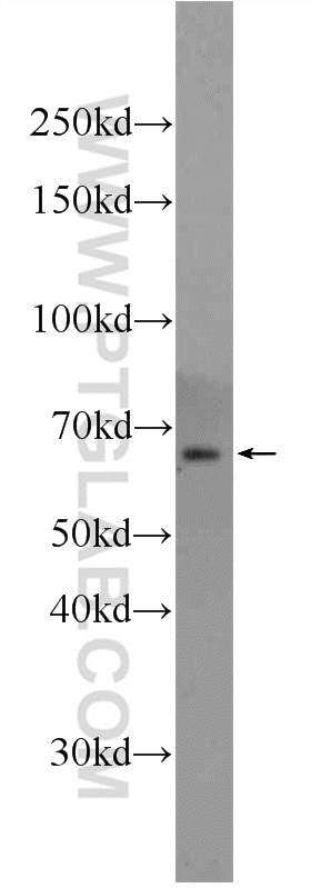 WB analysis of HepG2 using 24738-1-AP