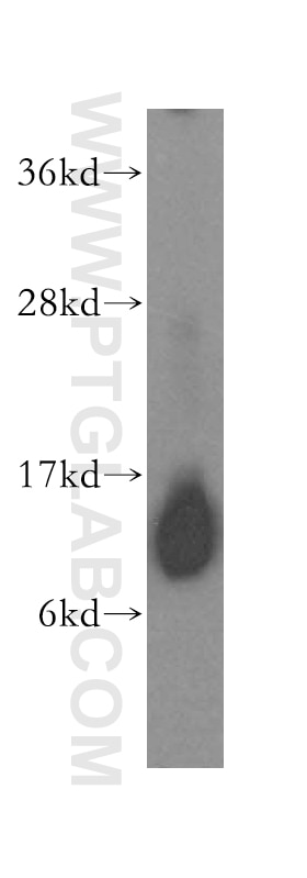 Western Blot (WB) analysis of human kidney tissue using IMMP2L Polyclonal antibody (15970-1-AP)