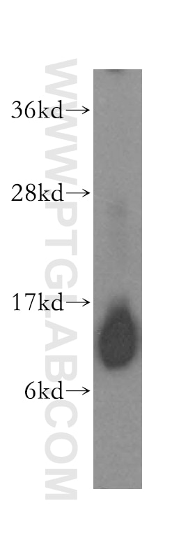 WB analysis of human kidney using 15970-1-AP