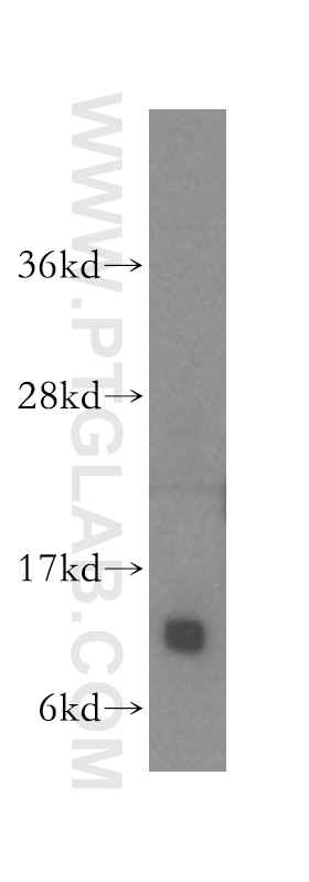Western Blot (WB) analysis of mouse skeletal muscle tissue using IMMP2L Polyclonal antibody (15970-1-AP)