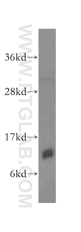 Western Blot (WB) analysis of human heart tissue using IMMP2L Polyclonal antibody (15970-1-AP)