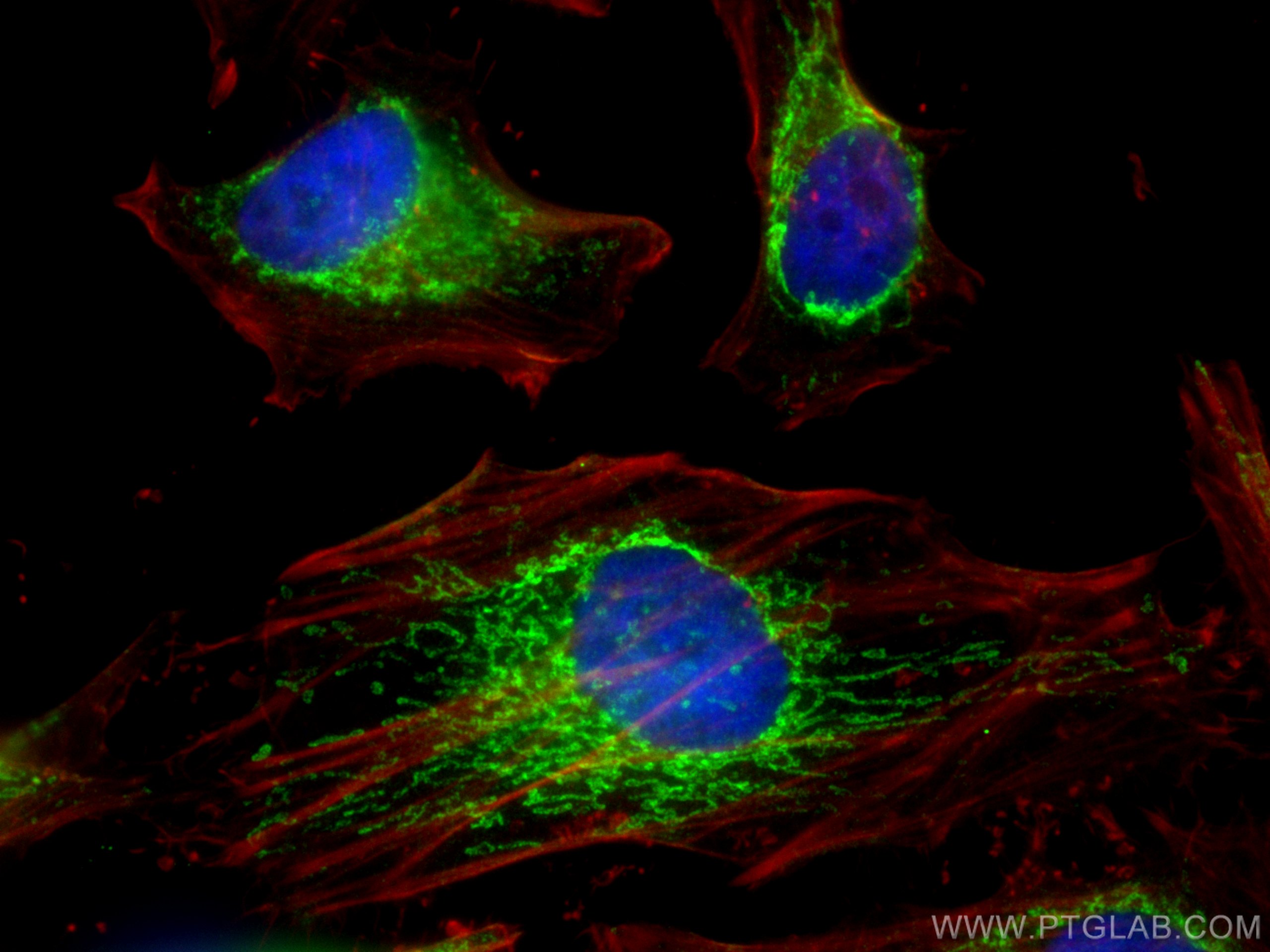 IF Staining of HeLa using 10179-1-AP