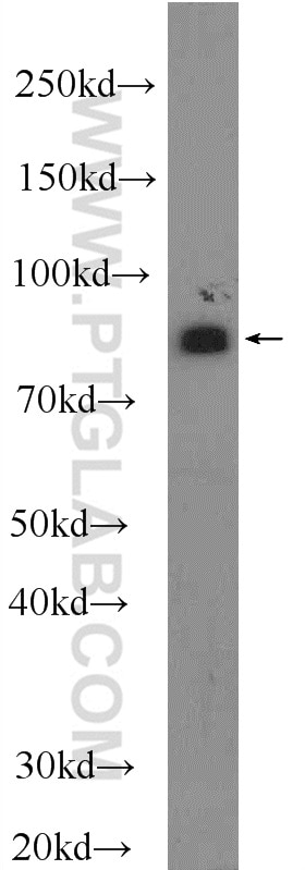 Western Blot (WB) analysis of HepG2 cells using Mitofilin Polyclonal antibody (10179-1-AP)