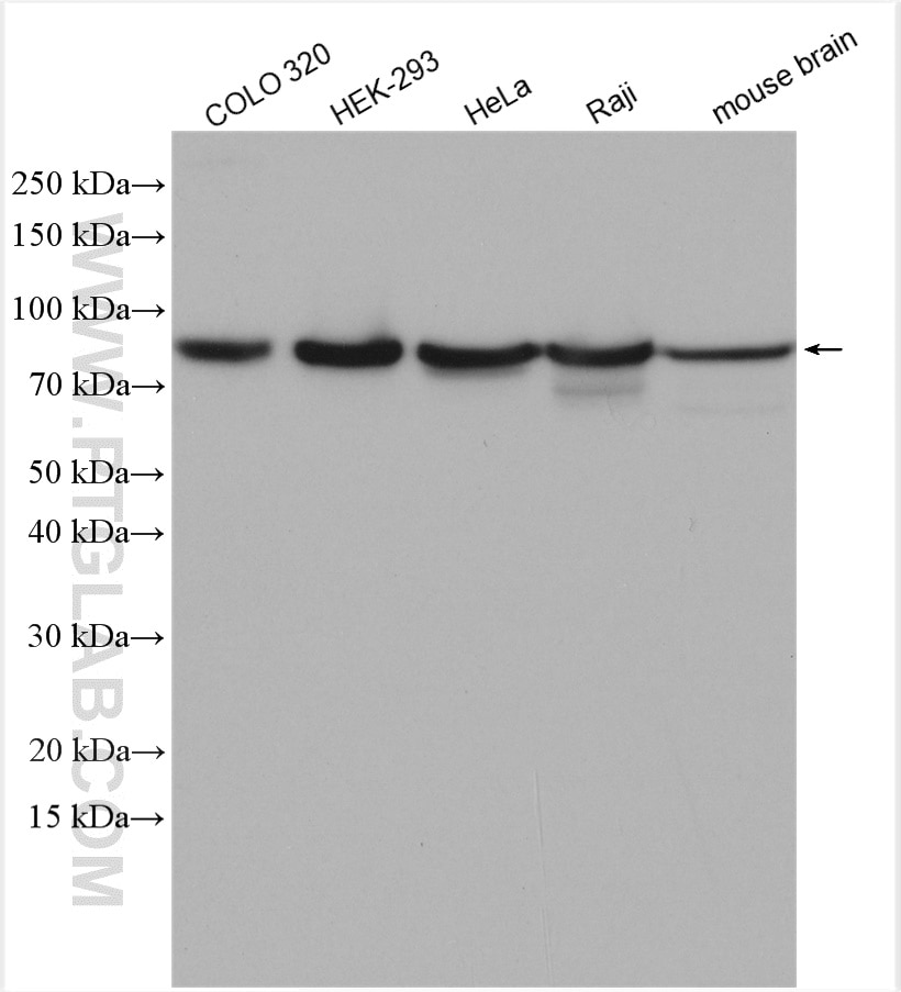 Western Blot (WB) analysis of various lysates using Mitofilin Polyclonal antibody (10179-1-AP)