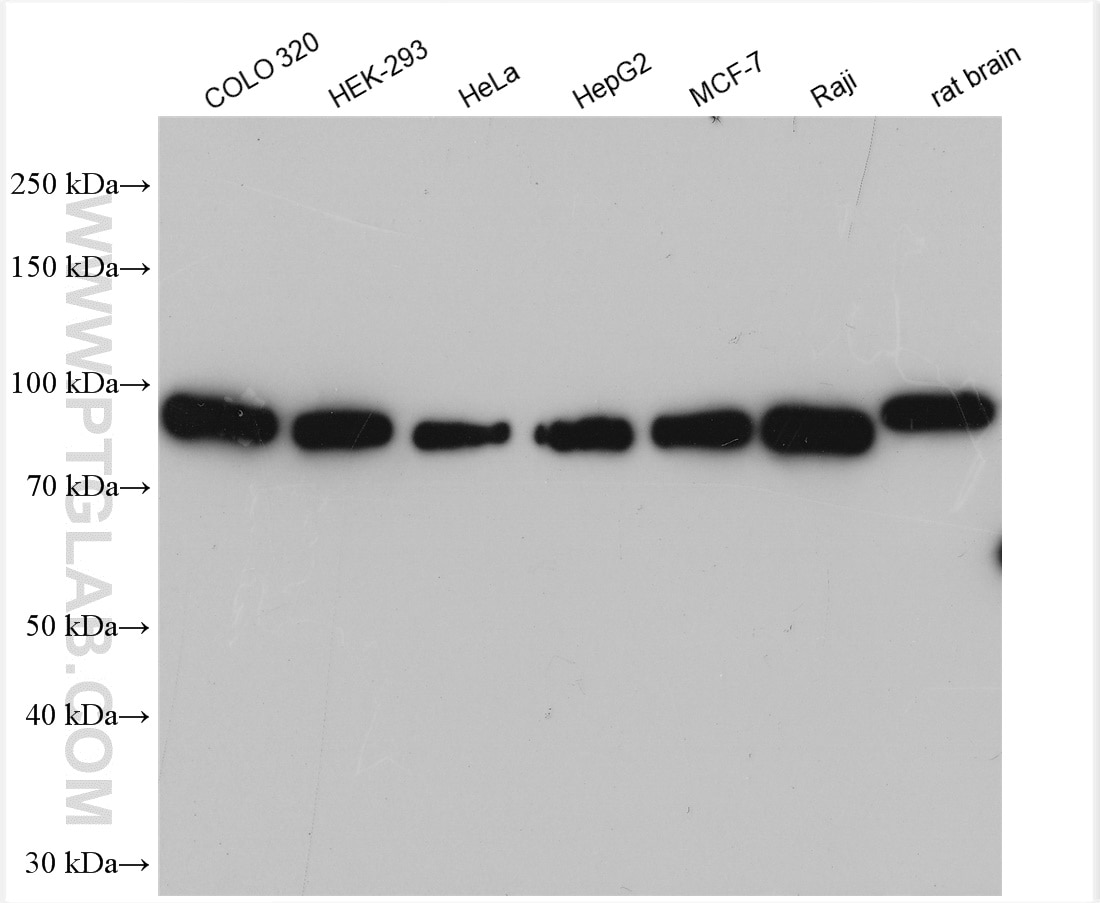 Western Blot (WB) analysis of various lysates using Mitofilin Polyclonal antibody (10179-1-AP)