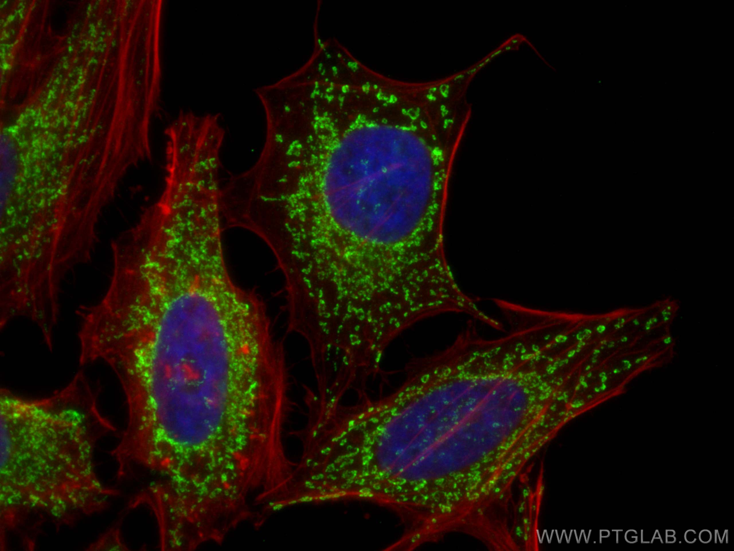 Immunofluorescence (IF) / fluorescent staining of HeLa cells using IMMT Monoclonal antibody (68226-1-Ig)