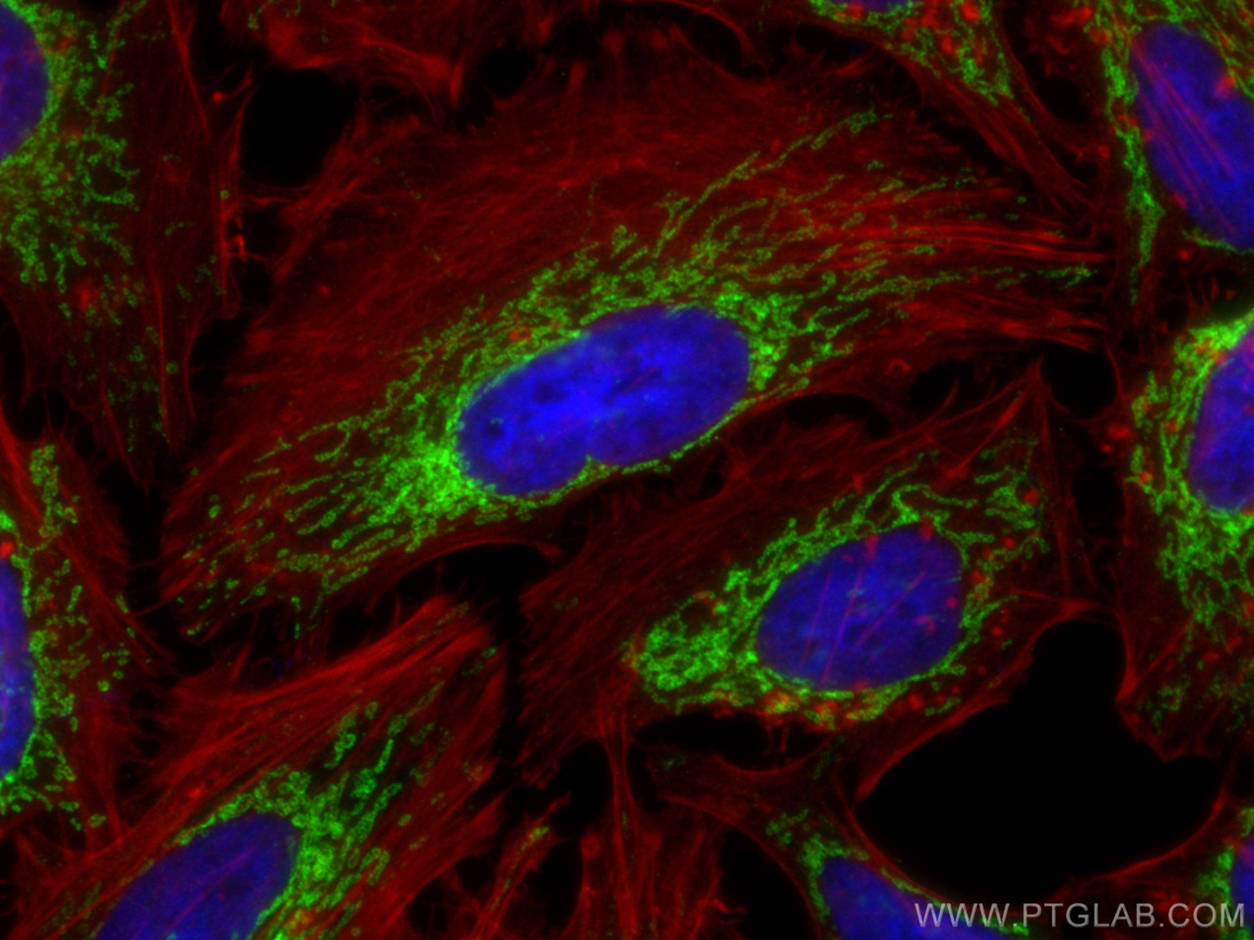 Immunofluorescence (IF) / fluorescent staining of HeLa cells using IMMT Monoclonal antibody (68226-1-Ig)