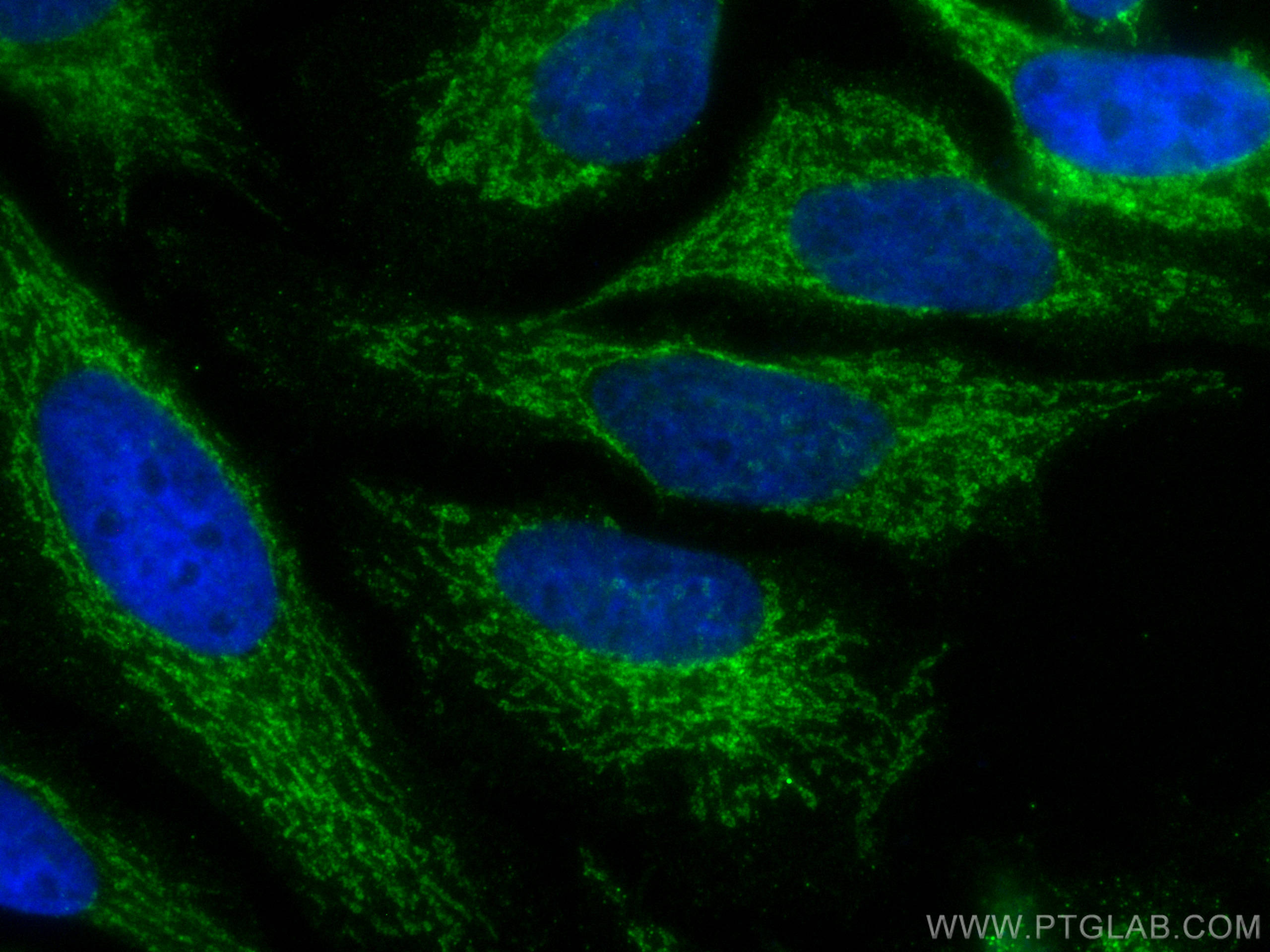 Immunofluorescence (IF) / fluorescent staining of HeLa cells using CoraLite® Plus 488-conjugated IMMT Monoclonal anti (CL488-68226)