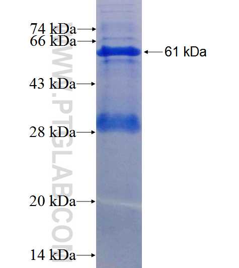 IMMT fusion protein Ag0102 SDS-PAGE