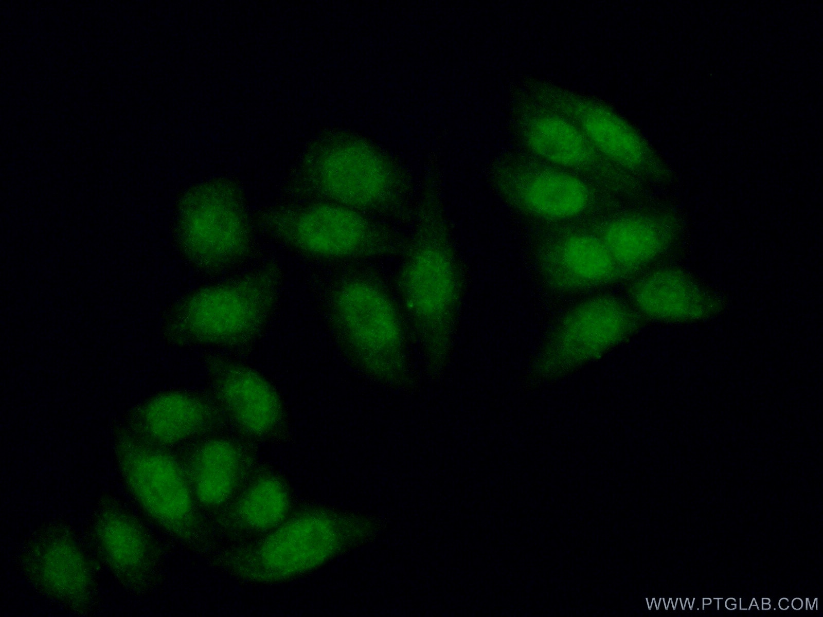 Immunofluorescence (IF) / fluorescent staining of HeLa cells using IMP3 Polyclonal antibody (12750-1-AP)