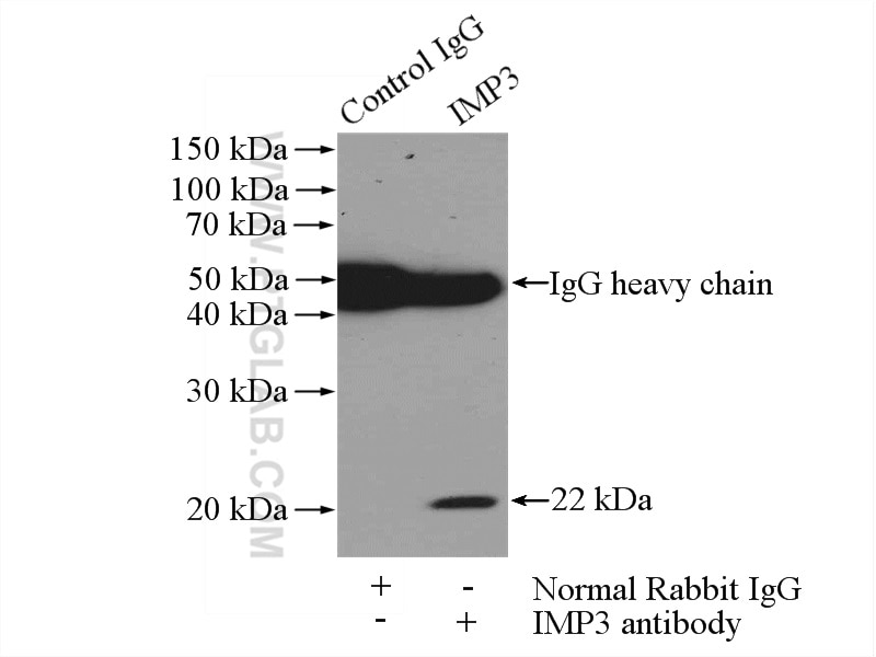 Immunoprecipitation (IP) experiment of HeLa cells using IMP3 Polyclonal antibody (12750-1-AP)
