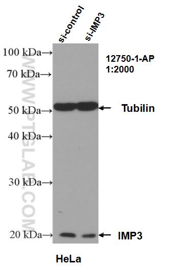 Western Blot (WB) analysis of HeLa cells using IMP3 Polyclonal antibody (12750-1-AP)