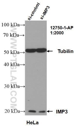 WB analysis of HeLa using 12750-1-AP