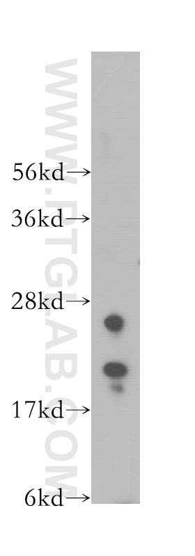 Western Blot (WB) analysis of MCF-7 cells using IMP3 Polyclonal antibody (12750-1-AP)