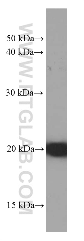 Western Blot (WB) analysis of HeLa cells using IMP3 Monoclonal antibody (66247-1-Ig)