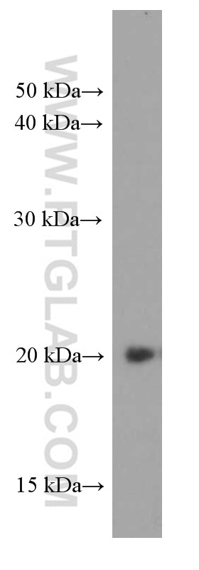 Western Blot (WB) analysis of SKOV-3 cells using IMP3 Monoclonal antibody (66247-1-Ig)