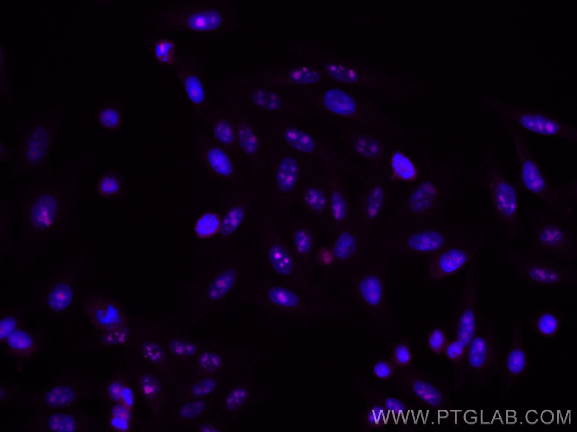 Immunofluorescence (IF) / fluorescent staining of HepG2 cells using CoraLite® Plus 647-conjugated IMP3 Monoclonal anti (CL647-66247)