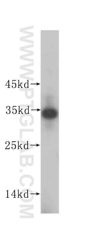 Western Blot (WB) analysis of HeLa cells using IMP4 Polyclonal antibody (16205-1-AP)