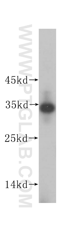 WB analysis of HeLa using 16205-1-AP