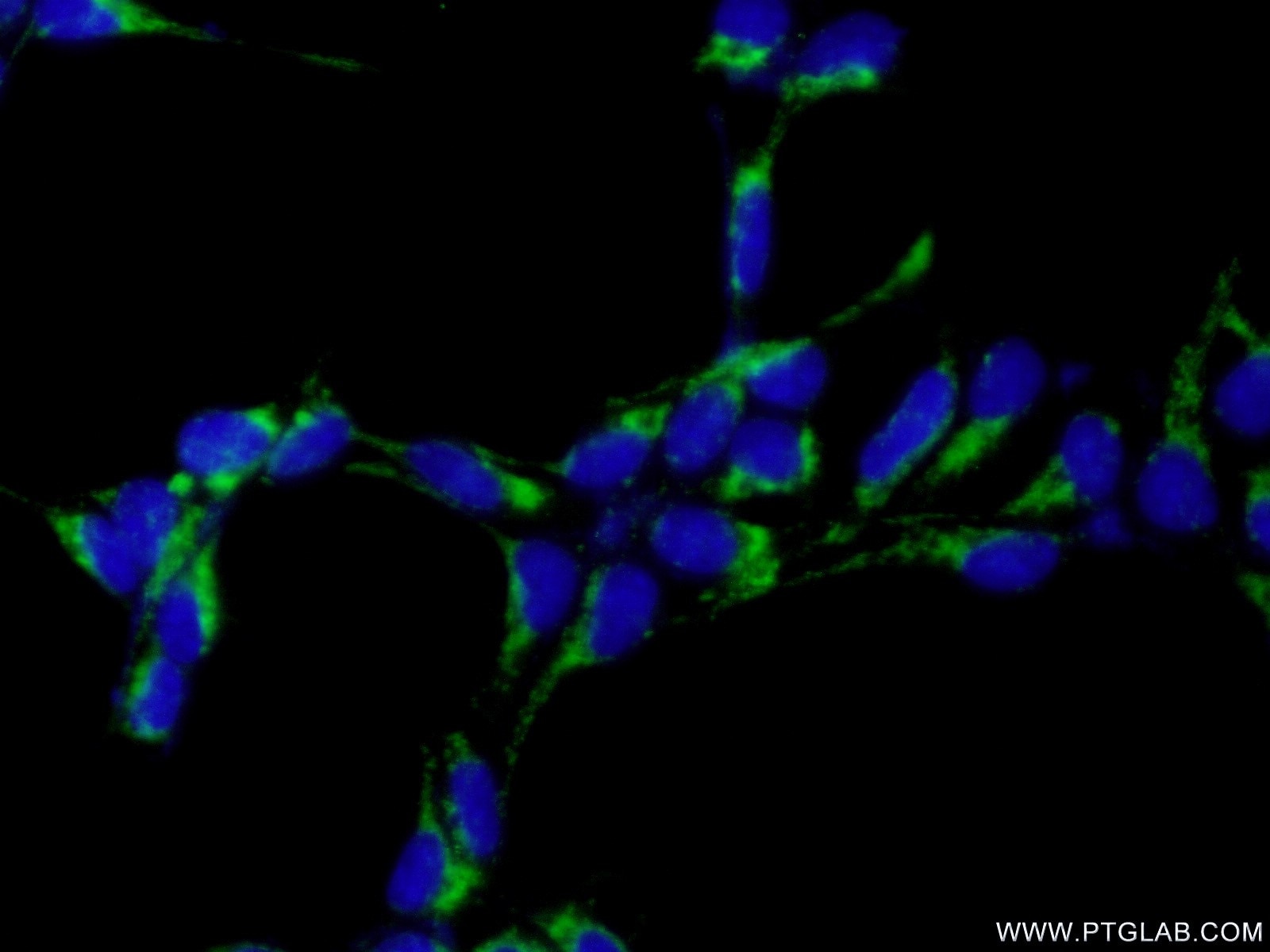 Immunofluorescence (IF) / fluorescent staining of HEK-293 cells using IMP5 Polyclonal antibody (12664-1-AP)