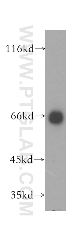 Western Blot (WB) analysis of human liver tissue using IMP5 Polyclonal antibody (12664-1-AP)