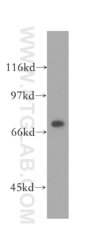 Western Blot (WB) analysis of HEK-293 cells using IMP5 Polyclonal antibody (12664-1-AP)